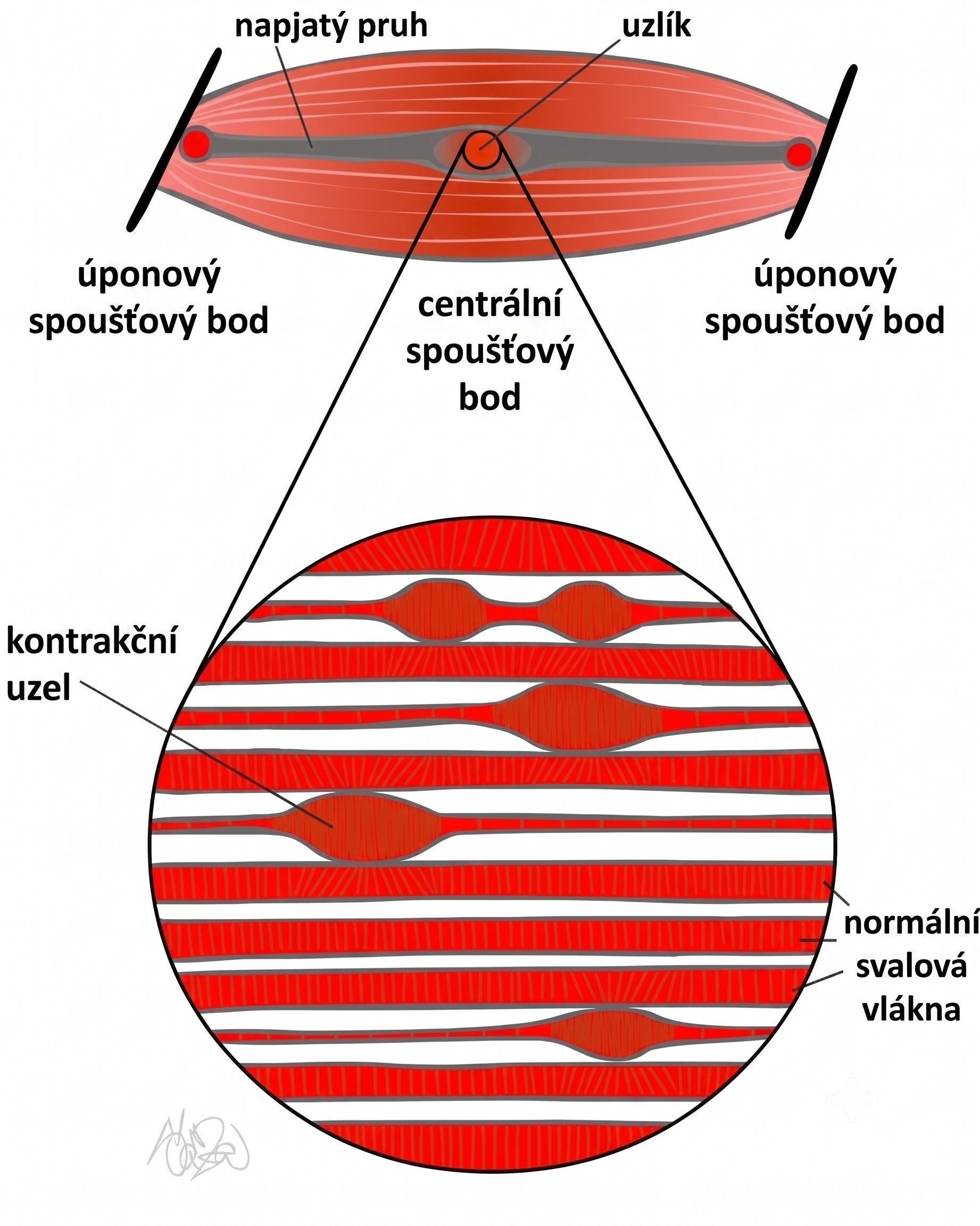 Anatomický model spoušťového bodu